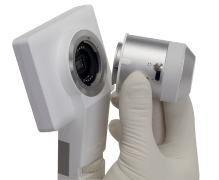 Lente para Dermatoscopia de cámara multidisciplinaria Horus 1 Lente para Dermatoscopia de camara multidiciplinaria Horus-0