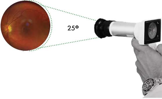 HORUS 25 , EZ-Horus Camara con Enfoque Manual incluye lente EZ-Horus de 25° 6 HORUS 25 , EZ-Horus Camara con Enfoque Manual incluye lente EZ-Horus de 25° -2762