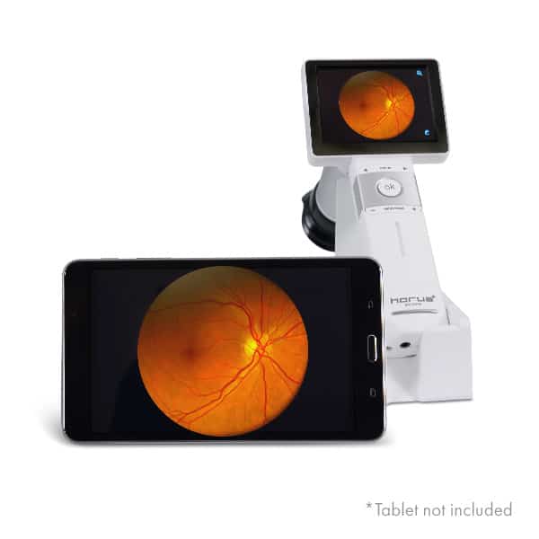 HORUS 25 , EZ-Horus Camara con Enfoque Manual incluye lente EZ-Horus de 25° 5 HORUS 25 , EZ-Horus Camara con Enfoque Manual incluye lente EZ-Horus de 25° -2426