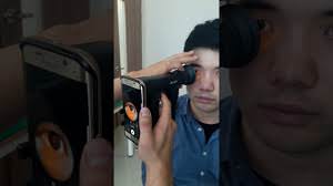 Video Oftalmoscopio NUN de wikioptics incluye adaptador para Smart Phone 6 Video Oftalmoscopio NUN de wikioptics incluye adaptador para Smart Phone -3378