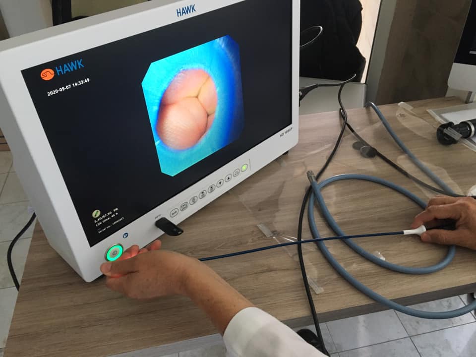 Tele Pack Hawk para video Endoscopia full HD 22" 5 Tele Pack Hawk para video Endoscopia full HD 22" - Image 5