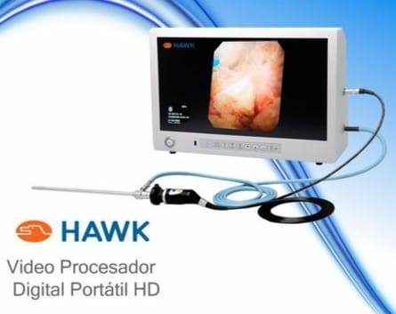 Tele Pack Hawk para video Endoscopia full HD 22" 3 Tele Pack Hawk para video Endoscopia full HD 22" - Image 3