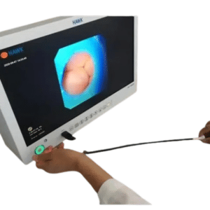 Tele Pack Hawk para video Endoscopia full HD 22"