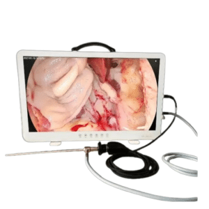 Tele pack HD 27" fuente de Luz LED, cámara Endoscópica