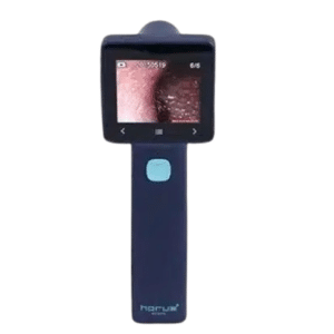 Otoscopio digital Ezer EZ-Horus OTO blue