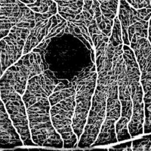 Modulo de Angiografía